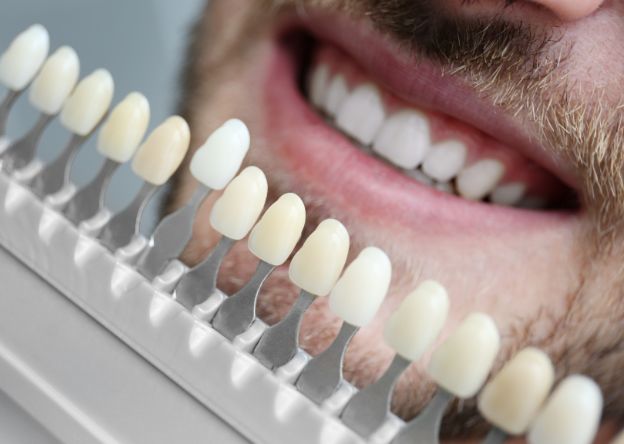 Change Your Smile Instantly with Veneers