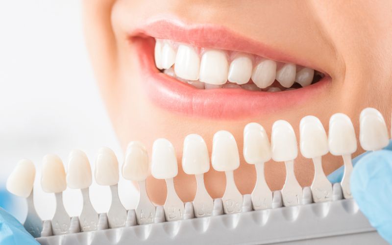 Dental Implants For Missing Teeth